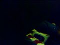 Dan Lee electric shock in his sleep Dan Lee electric shock in his sleep