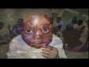 Uganda Video with Testimonies