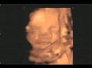 Ultrasound : The Movie