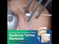Get Rid Of Eyebrow Tattoo