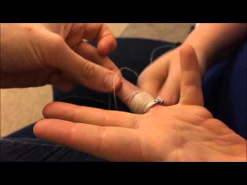 how to get off a ring that is swollen on the finger
