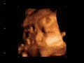 Carita a las 30 semanas Carita a las 30 semanas