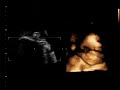 Nerea 27 semanas en la barriga de ama Nerea 27 semanas en la barriga de ama