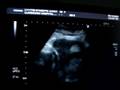 videos de Milo's Scan