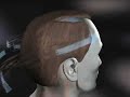 Hair Replacement Animation