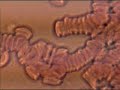 Darkfield Live Blood Analysis (8/27/2008 2:37 Am)