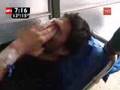 Fotógrafo herido en manifestaciones