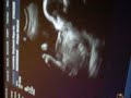 my bb boy 27 weeks my bb boy 27 weeks