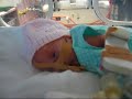 Goldie tired, but awake after CPAP
