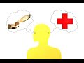 Poisonous Snake Bite (Its Educational)