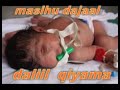 DALIL QIYAAMA - MASIHU DAAAAL