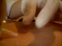 Carboxiterapia [Aplica��o em Estrias].flvestriass