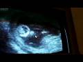 ultrasonido de bb ke saluda