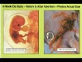Aborcja.... Aborcja....