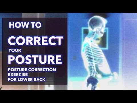 how to cure kyphosis and lordosis