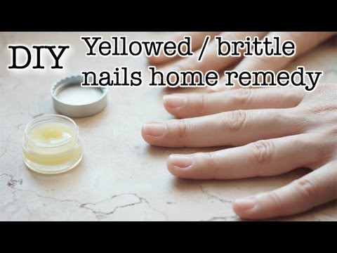 how to whiten orange nails