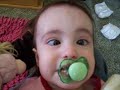 Glucose Transporter Type 1 Deficiency Syndrome  5/6/07