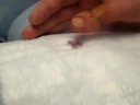 Ryans Thumb (Wire Being Pulled Out) Ryans Thumb (Wire Being Pulled Out)