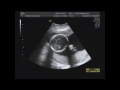 Click here to watch this video 妊婦健診22週目