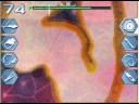 Trauma center under the knife 2 walkthrough operation 2