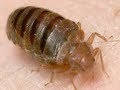 Bed Bugs (Beauty & Grooming Guru)