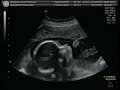 video ecografia 2da parte