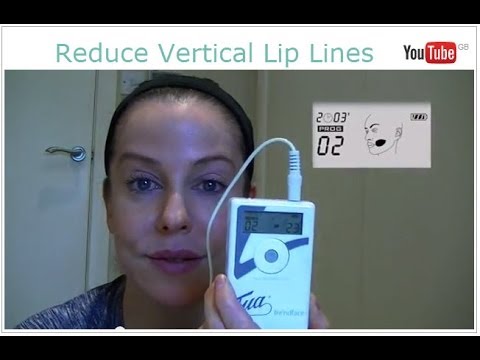 how to eliminate vertical lip lines