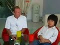 All-on-4 full mouth implant for edentulous jaws in Thailand All-on-4 full mouth implant for edentulous jaws in Thailand