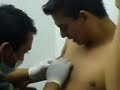 perforacion en el pezon