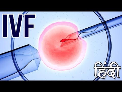 How IVF works? IVF Procedure in hindi | IVF Treatment for pregnancy video | Pregnancy Gyan