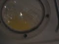 Chicken embryo