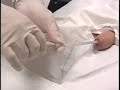 Male-Urethral-Stent-