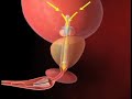 Male-Urethral-Stent-