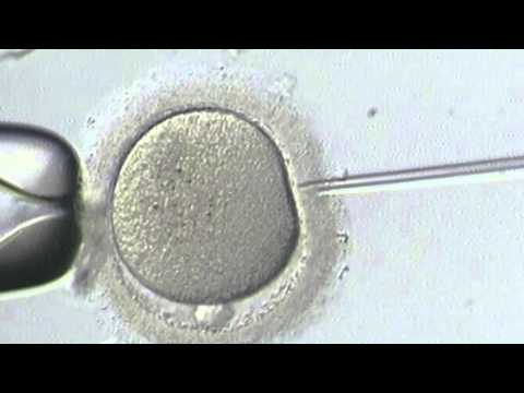 how to decide how many eggs to transfer