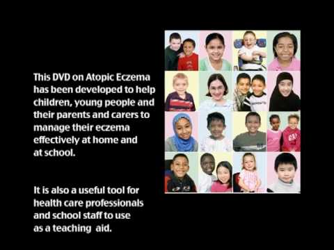 how to manage eczema