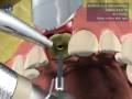 cirugia protesis dental - microdent systems s.l.