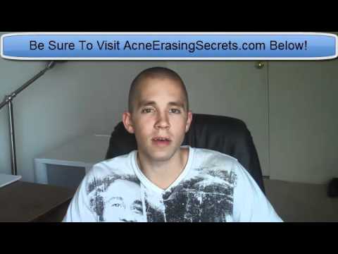 how to relieve birth control side effects