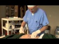 Real Women/Real Sexy: SMARTLIPO