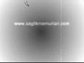 Fikrimin �nce G�l� Eylem Ko� M�zeyyen Senar D�et