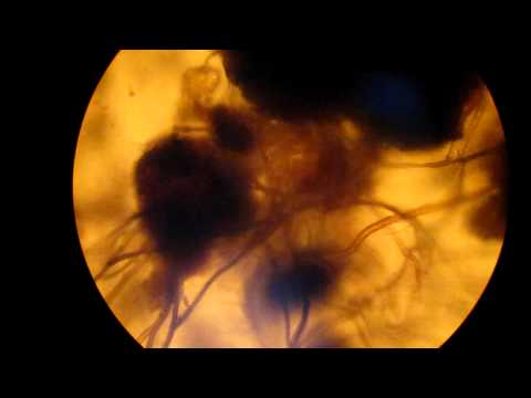 how to isolate fungi from leaves