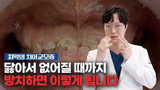 미래플란트치과