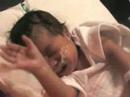 NICU Kalani 5 NICU Kalani 5
