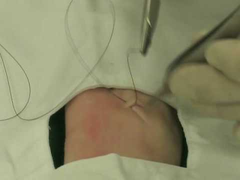 See video