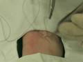 Suturing Workshop