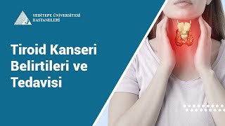 Tiroid Kanseri Belirtileri ve Tedavisi  Prof Dr Er