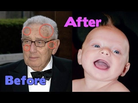 how to eliminate age spots naturally