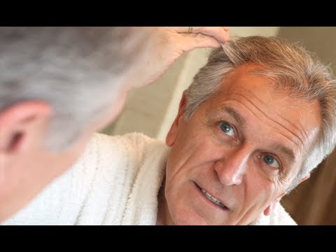how to do hair transplant at home