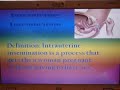 Intrauterine Insemination