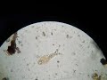 rotifer Habrotrocha visa found in leaf litter, Poland