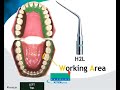 H2L and H2R and power settings